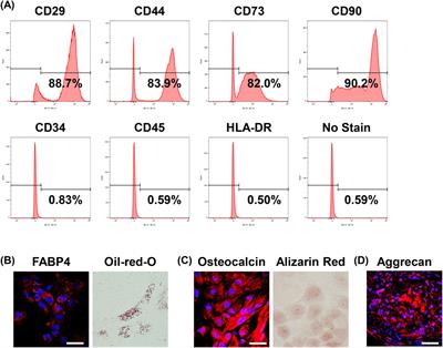 Human urine-derived stem cells: potential therapy for psoriasis-like dermatitis in mice